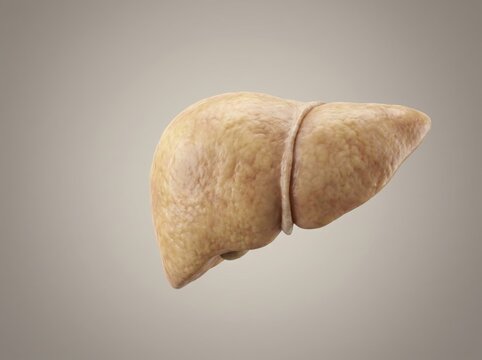 Liver Disease Fatty Close up Gigapixel Photo