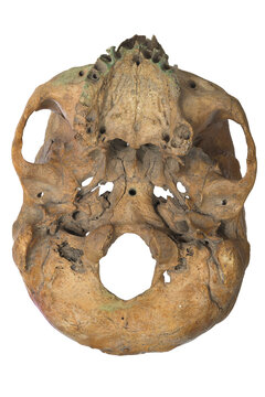 Inferior view of human skull showing base of cranium and foramina