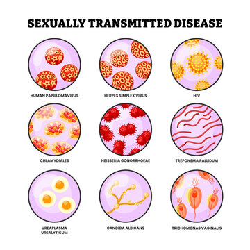 Different types of Sexually transmitted disease infection set collection. Labeled human papillomavirus, herpes simplex virus, hiv, chlamydiales, neisseria, treponema, ureaplasma, candida, trichomonas.