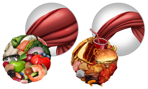 Malnutrition Muscle Loss and tissue Atrophy as a decrease in size of muscles and reduced strength from disuse aging or illness as Cancer Cachexia with appetite reduction due to flesh disease losing ph