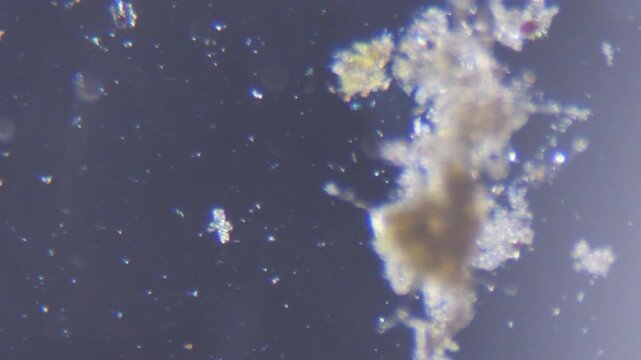 Microorganisms and algae in water river through an optical microscope