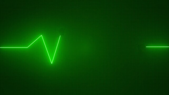 Heartbeat cardiogram signal, monitor interface loading icon