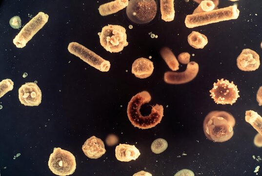 Various microscopic organisms, likely bacteria or fungi, suspended in a dark liquid.