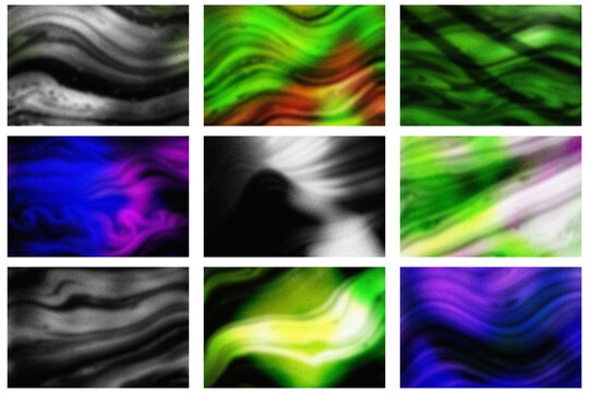 Medical ultrasound scans showing grayscale, color Doppler, and elastography imaging techniques for vascular and tissue assessment.
