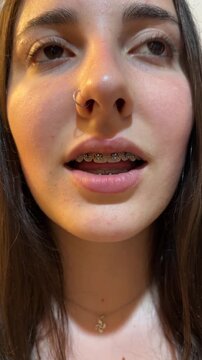 Detalle del rostro de chica con brackets hablando