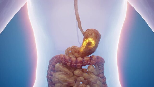Relieve the digestive system and restore the digestive tract to health