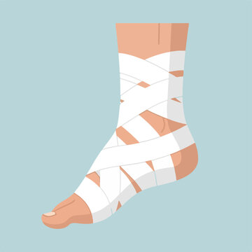 A foot with a bandaged ankle on a blue background