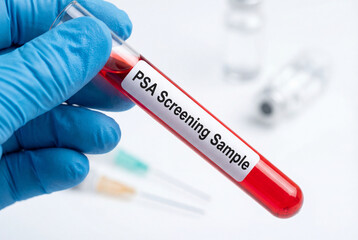 Obraz premium PSA screening sample in a test tube held by a doctor for a prostate cancer blood test