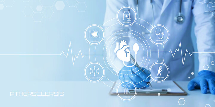 Doctor examining atherosclerosis symptoms and treatment options with digital medical icons and heart rate line on a blue background