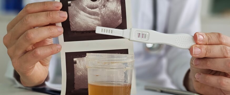 Gynecologist ultrasound images of embryo with positive pregnancy test and urine. Positive tests, no fetal egg on ultrasound