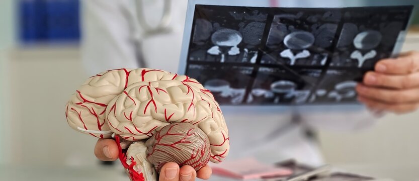 Doctor checks x-ray of brain using ST segment scanning. MRI of brain. Electroneuromyography