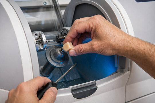 Modern digital dentistry process for creating same-day crowns using CEREC technology