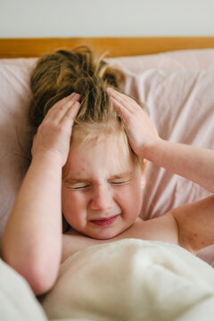 Caucasian female child suffering from chickenpox infection applying gel in bed