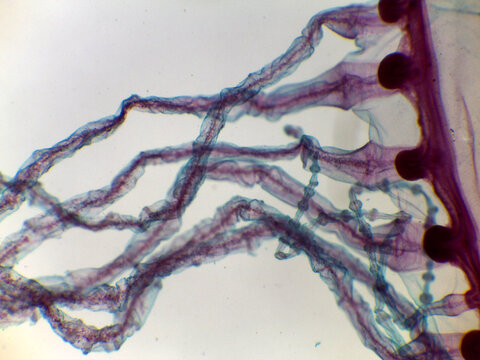 Gonionemus Jellyfish Velum Balancing Organ Tentacle Detail Light Microscop