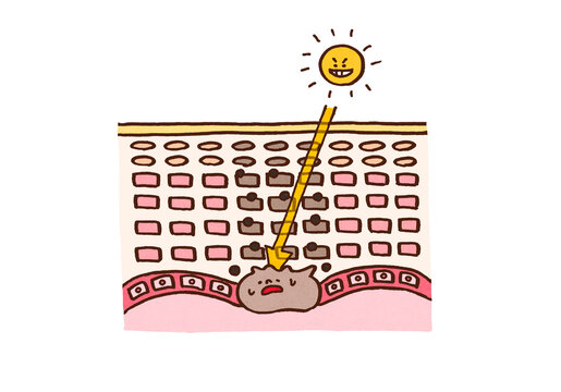 Diagram of melanocytes being stimulated by UV rays to produce melanin and cause skin spots, UV care concept