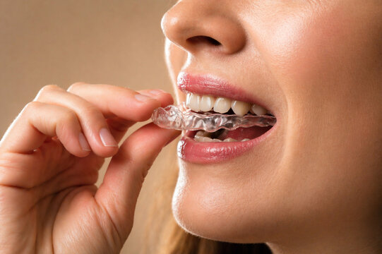 A woman using SureSmile clear aligners for a perfect smile and oral hygiene.