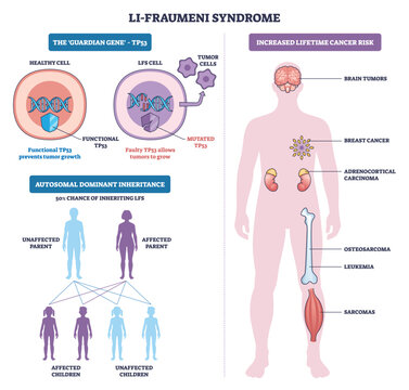 Li Fraumeni syndrome overview shows TP53 mutation, human silhouette cancer risk map, and tumor cells with DNA helix highlighting the faulty guardian gene. Outline diagram