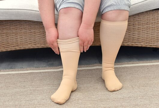 An adult woman wears compression stockings. They prevent varicose veins, support blood vessels, and improve circulation. They are indispensable for long trips and everyday life.
