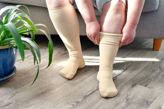 An adult woman wears compression stockings. They prevent varicose veins, support blood vessels, and improve circulation. They are indispensable for long trips and everyday life.