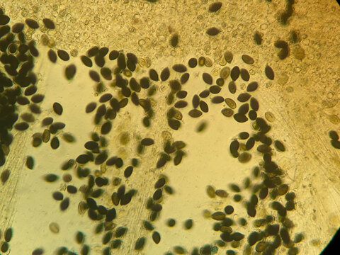 Microscopic View of Dark Elliptical Mushroom Spores on Glass Sl