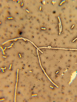 Microscopic View of Rod Shaped Bacteria Negative Stained With India