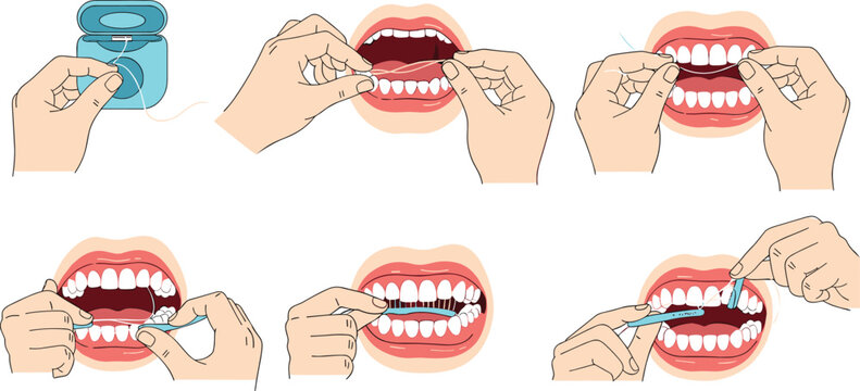 Step by step dental flossing guide illustration, proper oral hygiene technique with hands cleaning teeth in educational flat vector style design