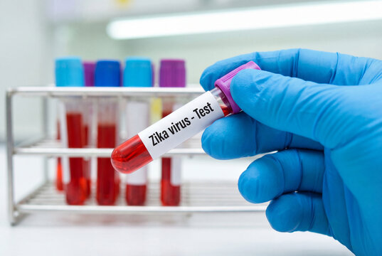 Laboratory technician holding a blood sample tube for zika virus testing in a medical clinic