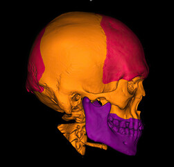 3D CT scan of skull with color segmentation showing cranial and facial bones. © Amri
