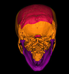 3D CT scan of skull with color segmentation showing cranial and facial bones. © Amri