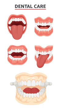 Medical vector illustration for dental care showing various human mouth diagrams, including open mouths with tongues, gums, and teeth, and a detailed dental typodont model.
