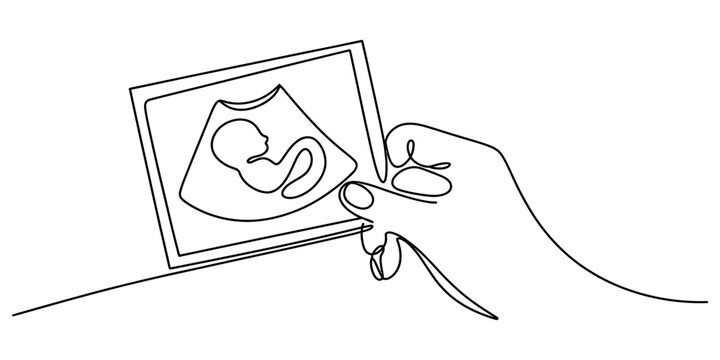 Continuous single line drawing of a hand holding an ultrasound scan showing a baby fetus during pregnancy checkup in medical clinic Vector, illustration