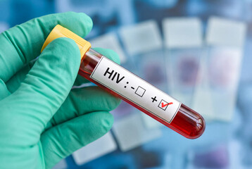 Fototapeta premium Hand in green glove holding positive HIV blood test tube
