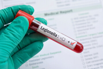 Obraz premium Hand holding positive legionella blood test tube sample