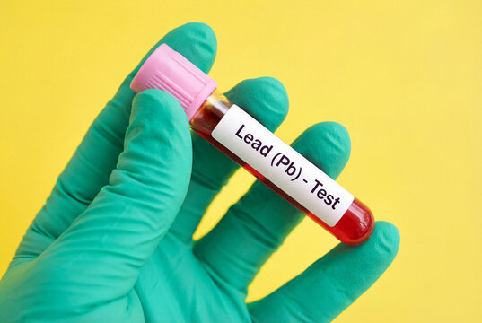 Hand in green glove holding lead pb blood test tube sample