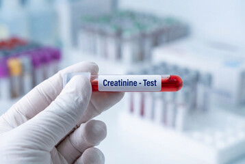 Fototapeta premium Gloved hand holding blood sample tube labeled creatinine test in lab