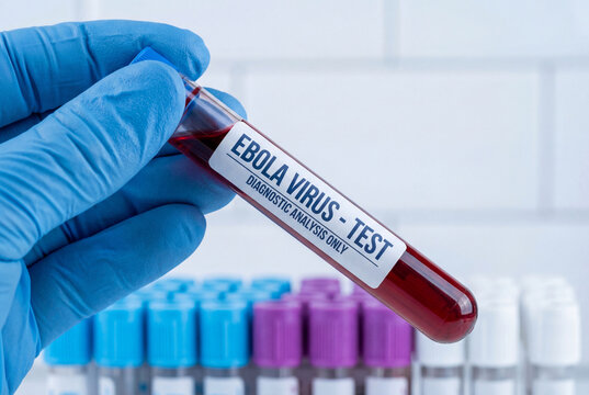 Researcher holds a blood sample in a test tube for an ebola virus test in a lab