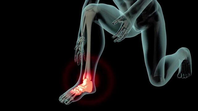 3D animation of human bones and joints, 3D health, arthritis, 3D video showing a foot with an ankle injury, cosmetic medical animation, and injury illustration