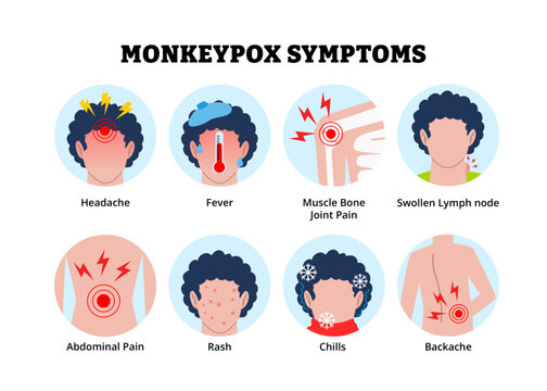 Monkeypox symptoms icon. Labeled man headache, fever muscle bone joint pain, swollen lymph node, abdominal pain, rash skin chills backache. Medical science educational illustration. Zoonotic disease.
