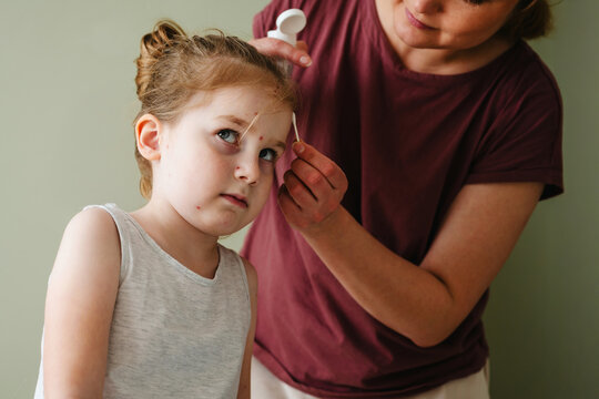 Caring mother applying soothing cream to child with chickenpox at home