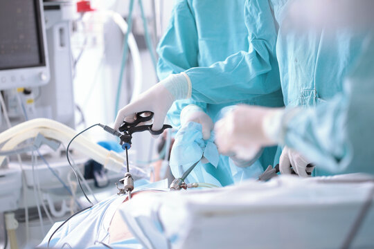 Surgeons perform laparoscopic surgery. Penetration into abdominal cavity. Modern abdominal surgery. Surgical intervention through small holes. Team of surgeons