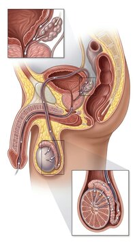 Masculine generative anatomy: human reproduce, sperm navigate, internal process, cell develop, male tract, body system, ejaculate fluid, vital function, semen pathway.
