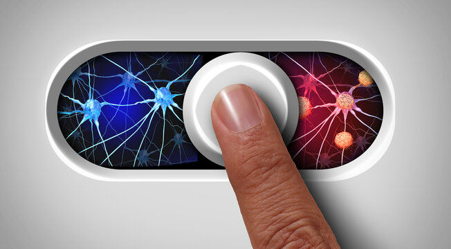 Alzheimer's String Switch as a scientific discovery as a molecular mechanism that triggers brain inflammation and damage in Alzheimers as a neurology science potential therapy for dementia treatment.