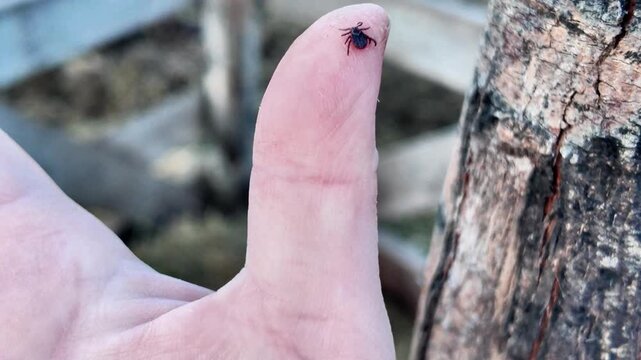 Macro close-up of tick crawling across human palm and finger. Parasite, disease risk, hygiene and outdoor safety concept.
