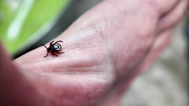 Macro close-up of tick crawling across human palm, moving onto arm and pausing as if preparing to bite. Parasite behavior, disease risk and outdoor safety concept.