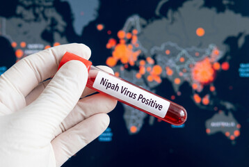 Obraz premium Scientist holding a blood sample test tube with nipah virus positive result in a lab