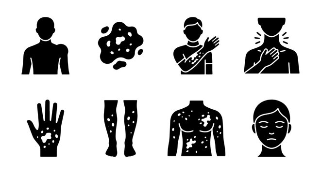 Set of Vitiligo and Skin Disease Icons featuring Depigmentation Patches on Face, Body, and Hands - Black Vector Illustration
