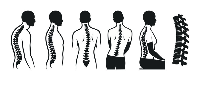 Spine posture and alignment set, human backbone anatomy icons, chiropractic and orthopaedic medical illustration, back pain symptoms, scoliosis and kyphosis curvature, sitting and standing human healt