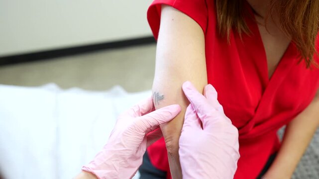 Dermatologist examining a patient's arm before and after a successful laser tattoo removal procedure, demonstrating the results of modern aesthetic medicine for correcting unwanted body art