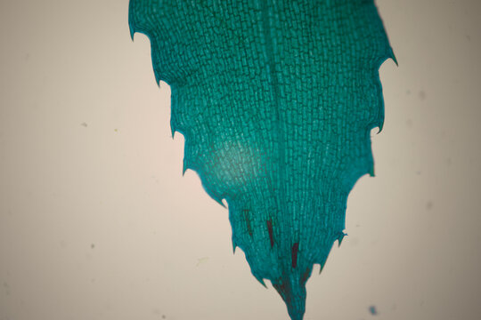 Microscopic close-up of turquoise-stained plant tissue with dense rectangular cell walls, fine texture, and spiky edges.