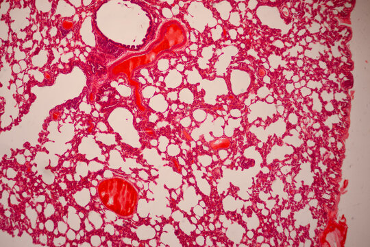 Microscopically stained section of lung tissue showing alveolar spaces, branching red blood vessels, and cellular structures.